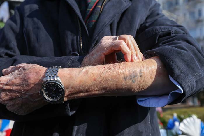 איש מבוגר שעבר שואה עם מספר קעקוע על הזרוע